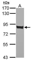 Anti-CD36 antibody used in Western Blot (WB). GTX112891